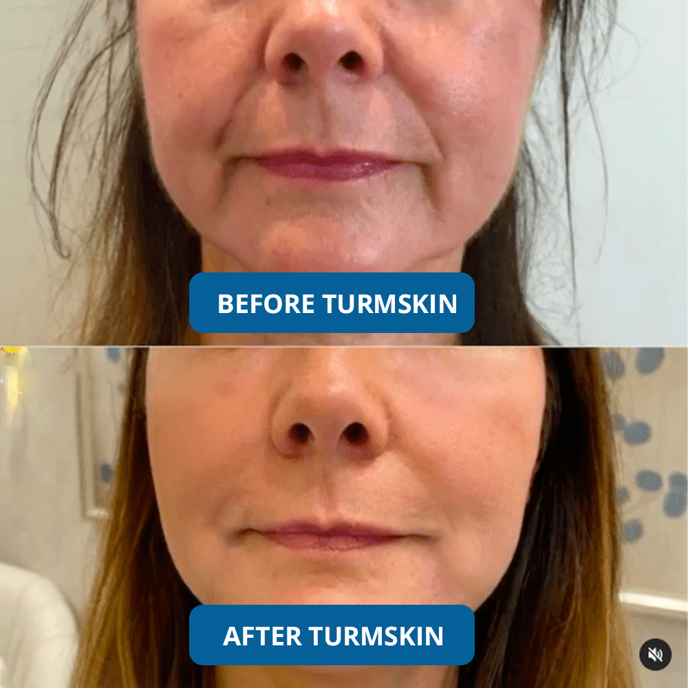 3% Hyaluronic Acid Ultra Hydrating Serum
